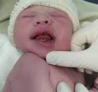 Bebê nasce com seis dentes no Mato Grosso do Sul